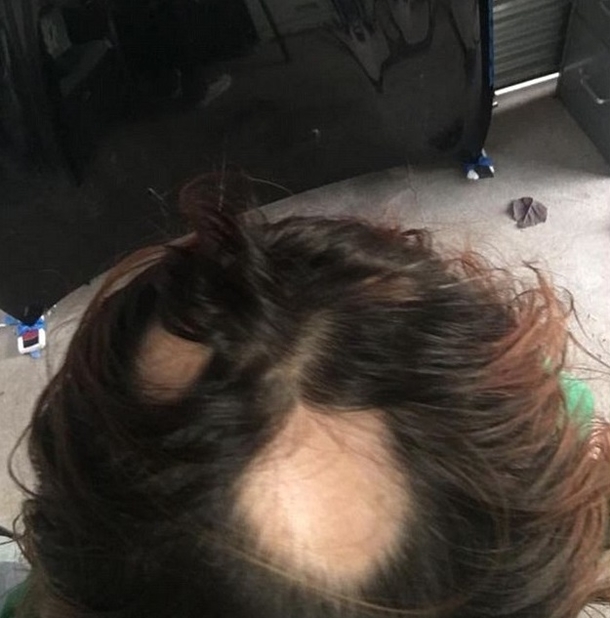 This Popular Shampoo Brand Is Causing People Across America To Lose Their Hair Overnight... - picture 4