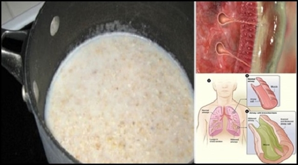 This Simple Drink Will Clear Mucus From Your Lungs And Give An Instant Boost To Your Immune System - picture 5