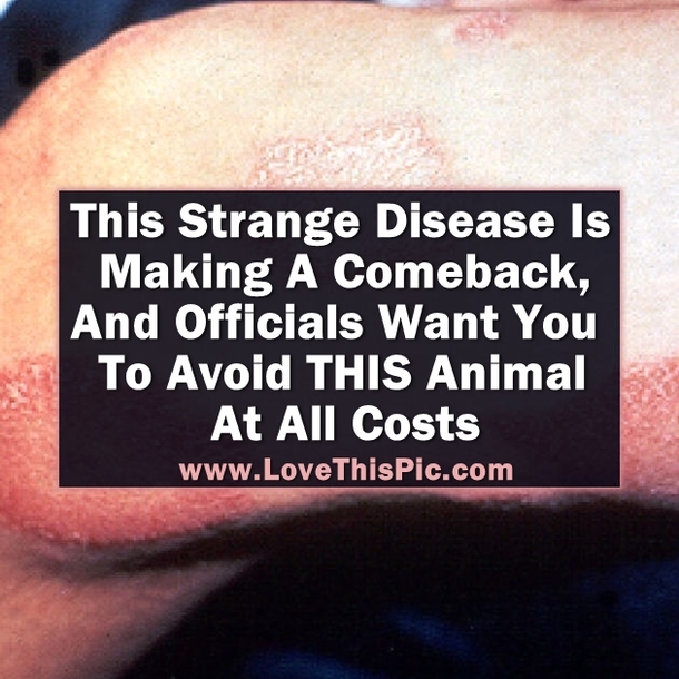 This Strange Disease Is Making A Comeback! Officials Say You Need To Avoid THIS Animal At All Costs
