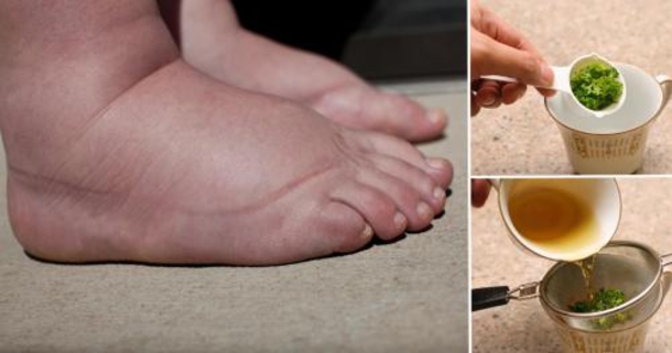 This Tea Is The Best Remedy For Swollen Legs, Wow This Works Like Magic! - picture 2