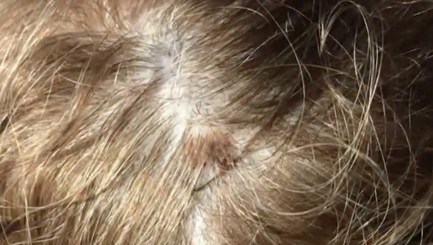 This Was A Typical Routine Hair Appointment, But Her Hair Colorist's Comment Saved Her Life - picture 2