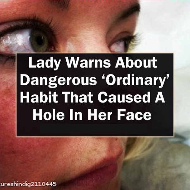 This Woman Is Warning Everyone About A Dangerous ‘Ordinary’ Habit That Caused A Hole In Her Face