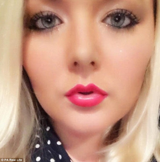 This Woman Is Warning Everyone About A Dangerous ‘Ordinary’ Habit That Caused A Hole In Her Face - picture 2