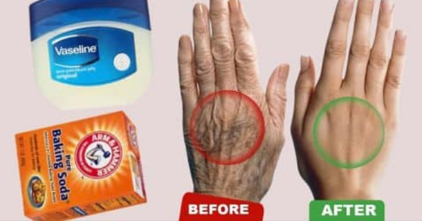 Tips for Achieving Soft, Smooth and Youthful Hands - picture 2