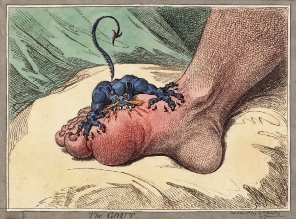 To Prevent Joint Pain & Gout, Try This! - picture 3