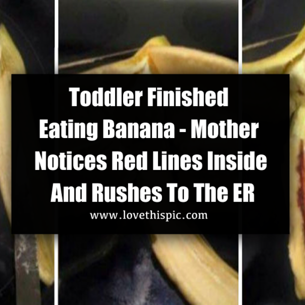 Toddler Finished Eating Banana - Mother Notices Red Lines Inside And Rushes To The ER