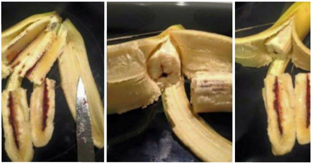 Toddler Finished Eating Banana - Mother Notices Red Lines Inside And Rushes To The ER - picture 2