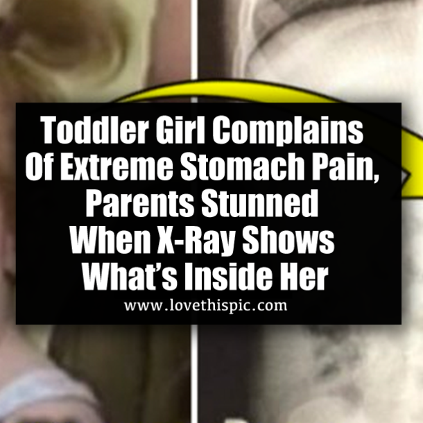Toddler Girl Complains Of Extreme Stomach Pain, Parents Stunned When X-Ray Shows What’s Inside Her