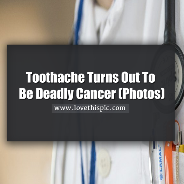 Toothache Turns Out To Be Deadly Cancer (Photos)