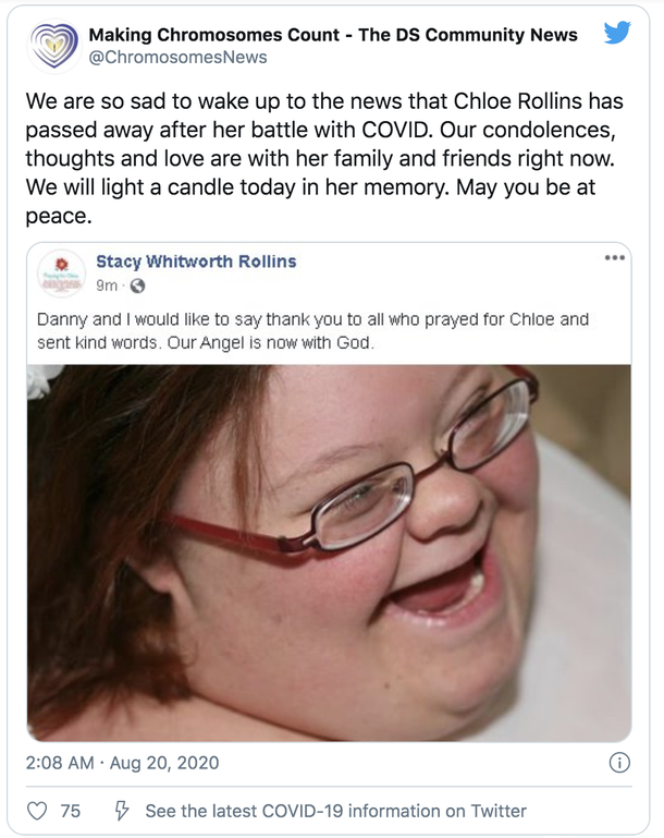 Tragic: Family decides to turn off ventilator of teen with Down syndrome hospitalized with COVID-19 - picture 2