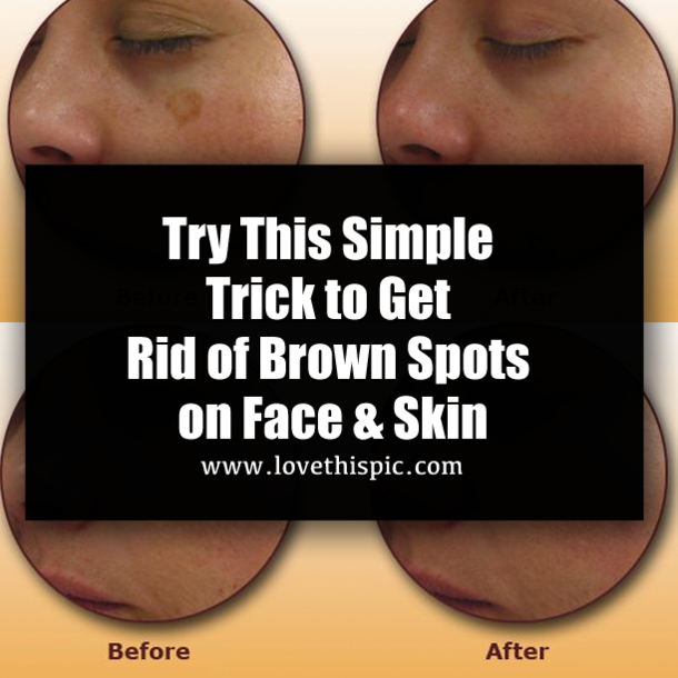 Try This Simple Trick to Get Rid of Brown Spots on Face & Skin