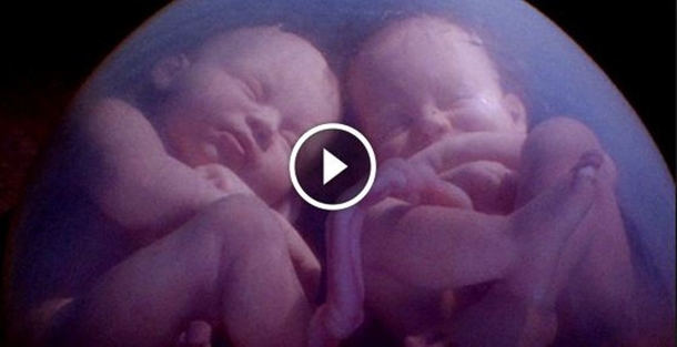 Twin Babies Caught On MRI Scan Fighting In Their Mother’s Womb! Amazing! - picture 2