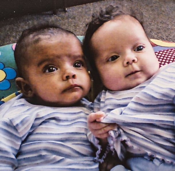Twin girls have different skin tones, so teachers accuse their Mother of lying about them being sisters - picture 3