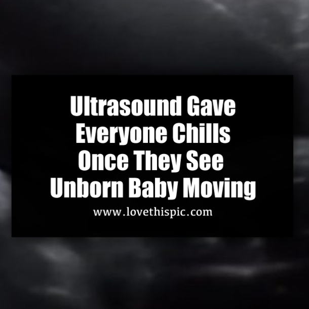 Ultrasound Gave Everyone Chills Once They See Unborn Baby Moving