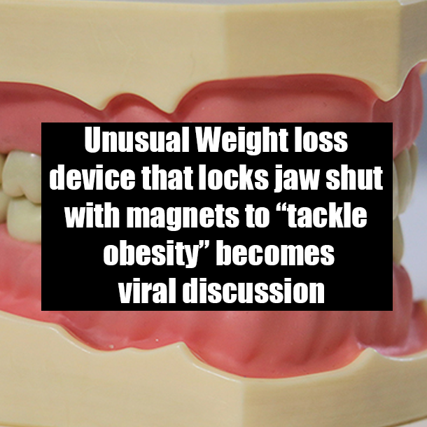 Unusual Weight loss device that locks jaw shut with magnets to “tackle obesity” becomes viral discussion