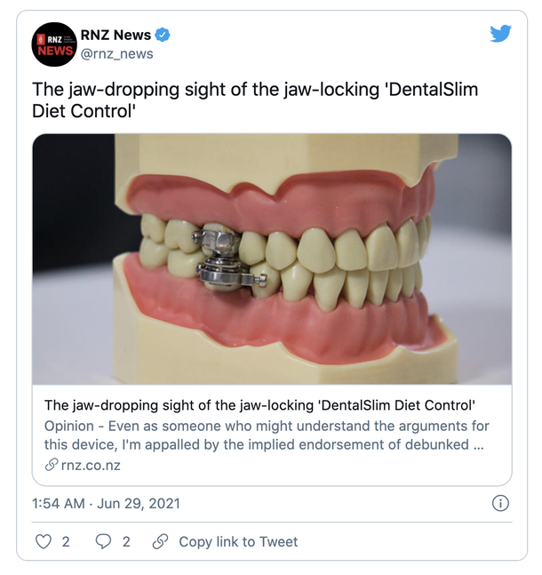 Unusual Weight loss device that locks jaw shut with magnets to “tackle obesity” becomes viral discussion - picture 2