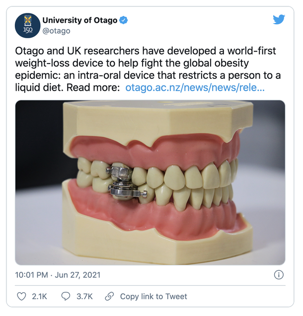 Unusual Weight loss device that locks jaw shut with magnets to “tackle obesity” becomes viral discussion - picture 3