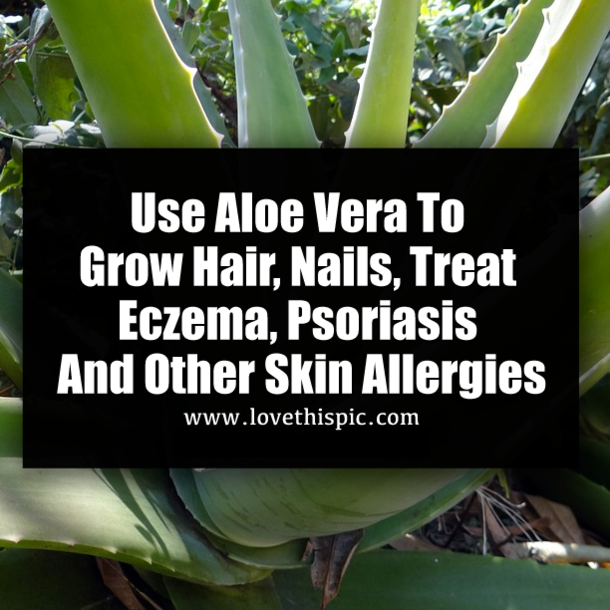Use Aloe Vera To Grow Hair, Nails, Treat Eczema, Psoriasis And Other Skin Allergies