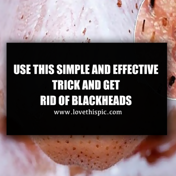 USE THIS SIMPLE AND EFFECTIVE TRICK AND GET RID OF BLACKHEADS