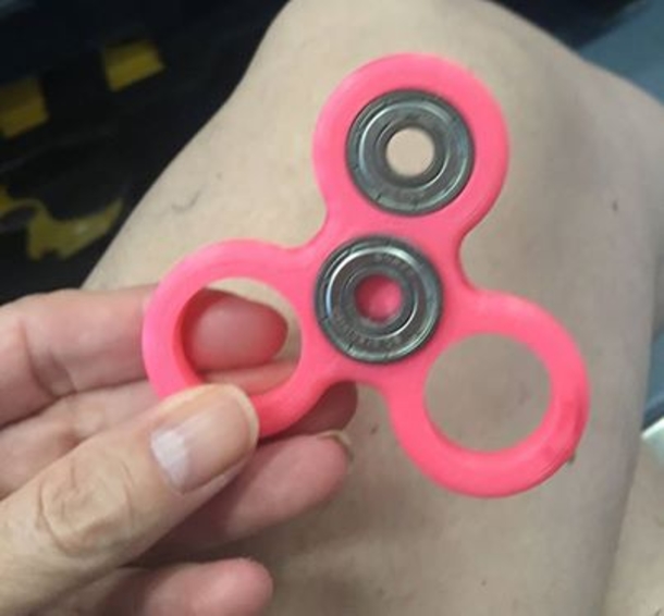WARNING If Your Kids Have ‘Fidget Spinners’ Throw Them Out NOW. THIS Shocking New Danger Just Discovered - picture 2