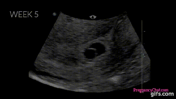 Watch The Complete Journey Of A Child In The Mother's Womb. This Is Amazing! - picture 4