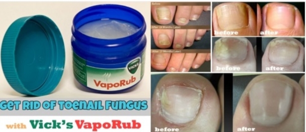 We All Have Baking Soda In Our Homes But Who Knew It Could Also Be Used For THIS... - picture 10