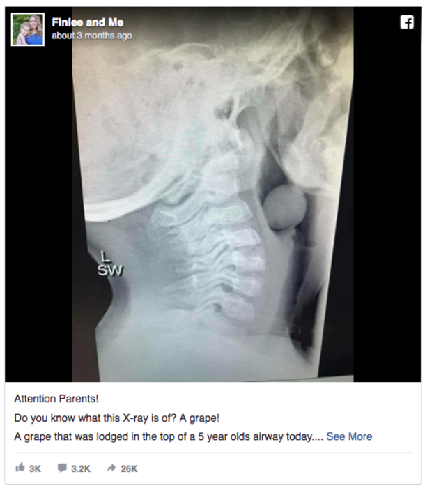 What Doctors Found While Looking At Little Boy's X-Ray Almost Killed Him, But Kids Still Eat It Every Single Day - picture 2