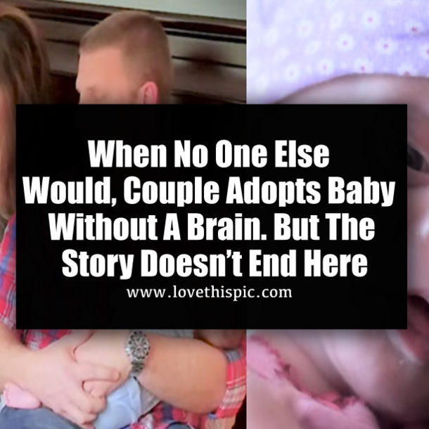 When No One Else Would, Couple Adopts Baby Without A Brain. But The Story Doesn’t End Here