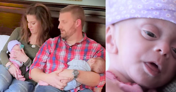 When No One Else Would, Couple Adopts Baby Without A Brain. But The Story Doesn’t End Here - picture 2