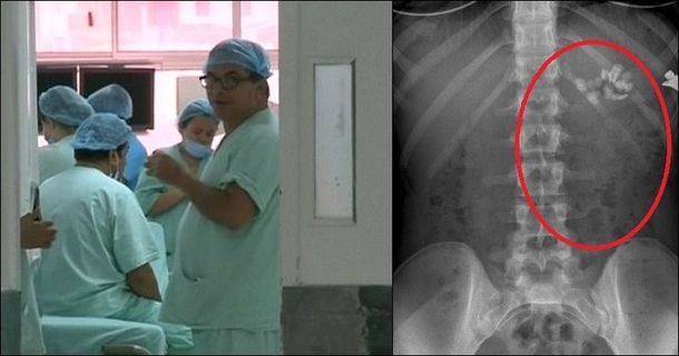 Wife Gets X-Ray For Gut Pain, Doctor Shocked To See What Was Really Inside Her - picture 2