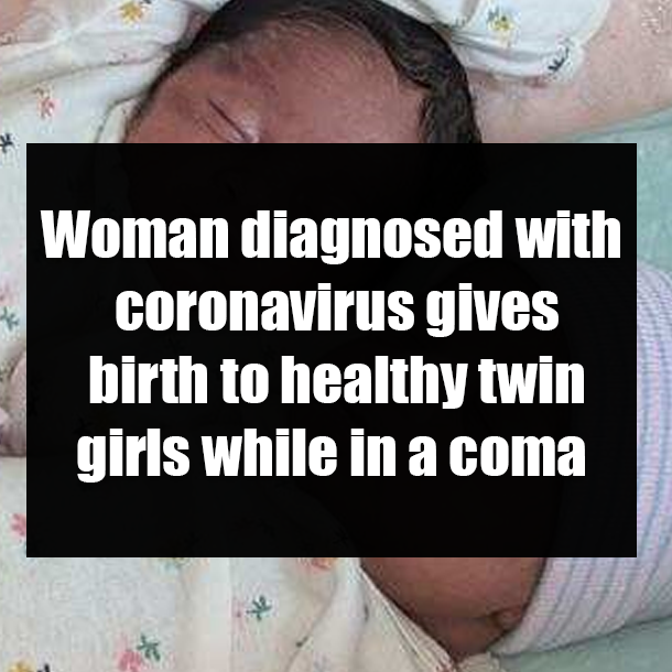 Woman diagnosed with coronavirus gives birth to healthy twin girls while in a coma