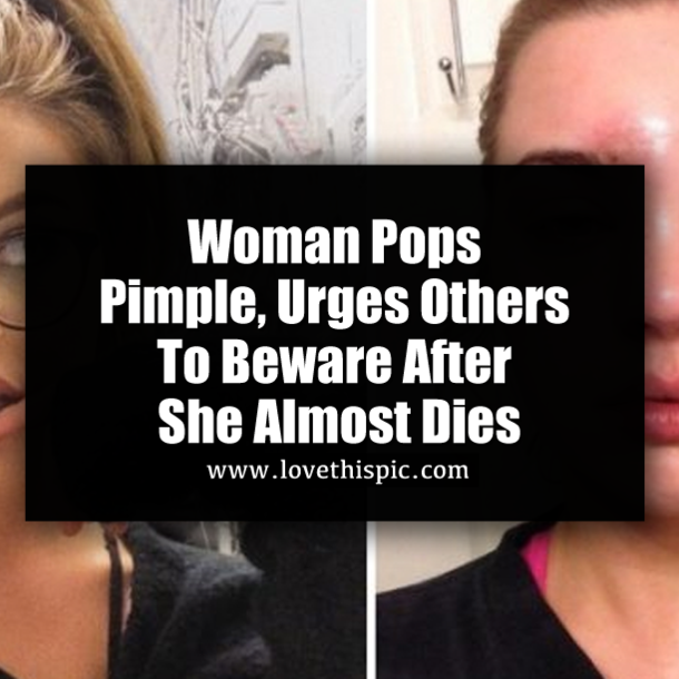 Woman Pops Pimple, Urges Others To Beware After She Almost Dies
