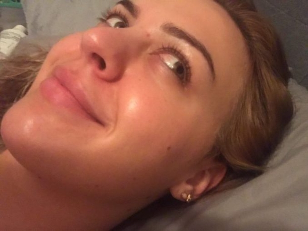 Woman Pops Pimple, Urges Others To Beware After She Almost Dies - picture 2
