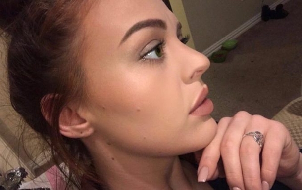 Woman Pops Pimple, Urges Others To Beware After She Almost Dies - picture 7