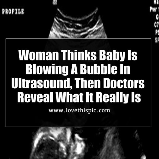 Woman Thinks Baby Is Blowing A Bubble In Ultrasound, Then Doctors Reveal What It Really Is