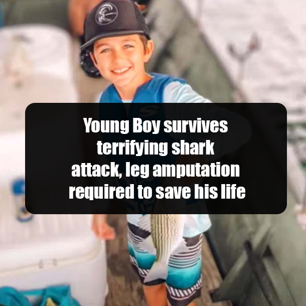 Young Boy survives terrifying shark attack, leg amputation required to save his life