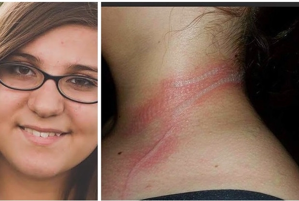 Young Girl Comes Running Down The Stairs Screaming In Pain, When She Tells The Mother The Cause She Is Shocked. Be Warned. - picture 2