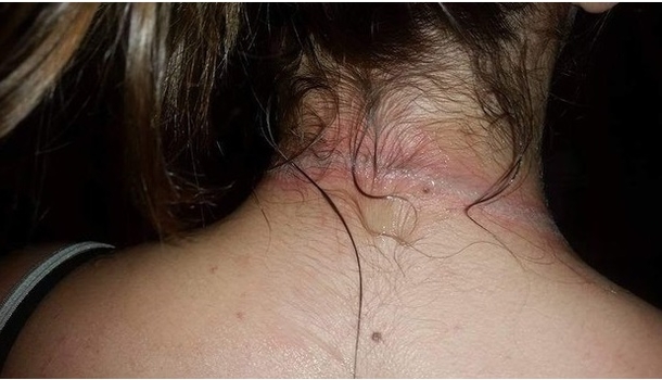 Young Girl Comes Running Down The Stairs Screaming In Pain, When She Tells The Mother The Cause She Is Shocked. Be Warned. - picture 3