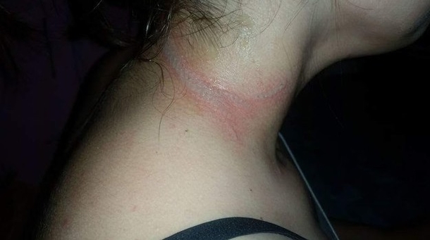 Young Girl Comes Running Down The Stairs Screaming In Pain, When She Tells The Mother The Cause She Is Shocked. Be Warned. - picture 4