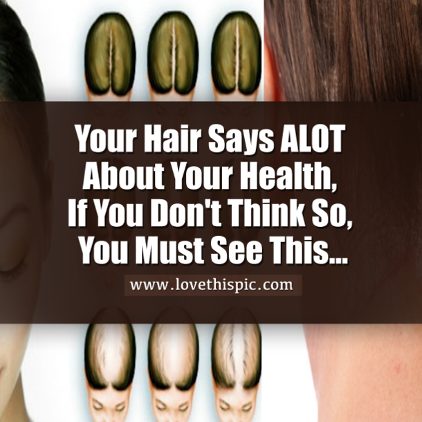 Your Hair Says ALOT About Your Health, If You Don't Think So, You Must See This...