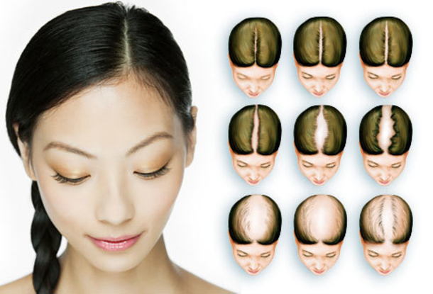 Your Hair Says ALOT About Your Health, If You Don't Think So, You Must See This... - picture 7