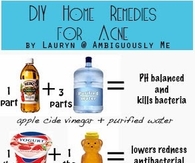 Home remedies for acne