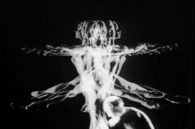 Pas de deux by Norman McLaren