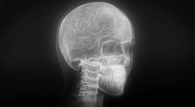 X-Ray Skeleton