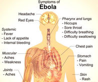 symptoms of ebola