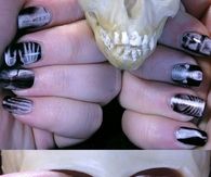 X Ray nails