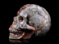 Tommyskull