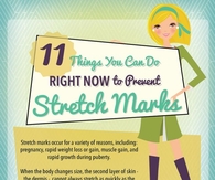11 Ways To Prevent Stretch Marks