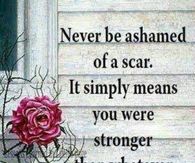 never be ashamed of a scar