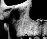 Close up of a skull